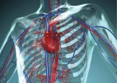 multivessel disease