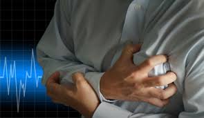 myocardial infarction