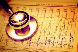 ventricular arrhythmias